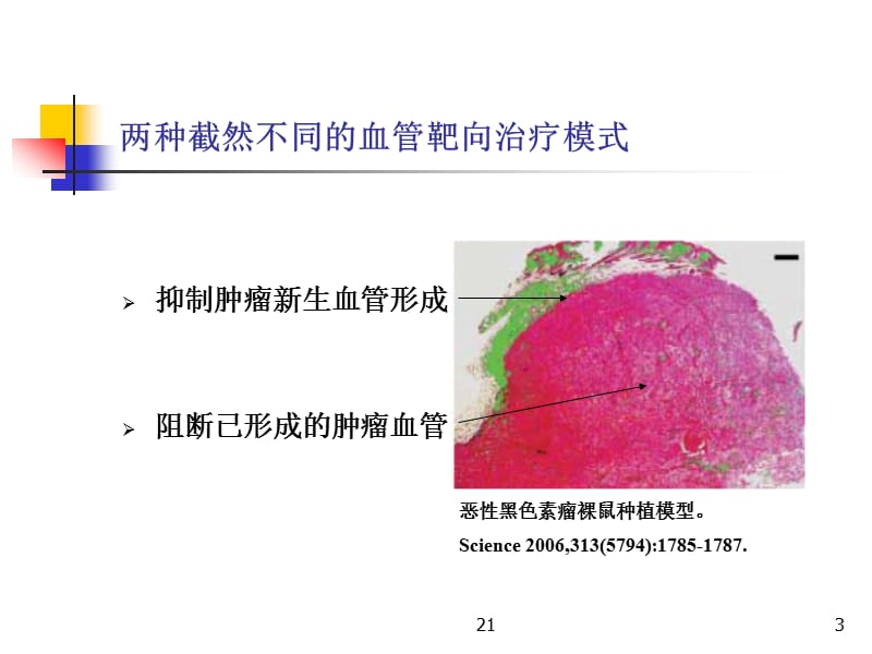 “肿瘤血管阻断剂”一类崭新的肿瘤血管靶向治疗药物.ppt_第3页