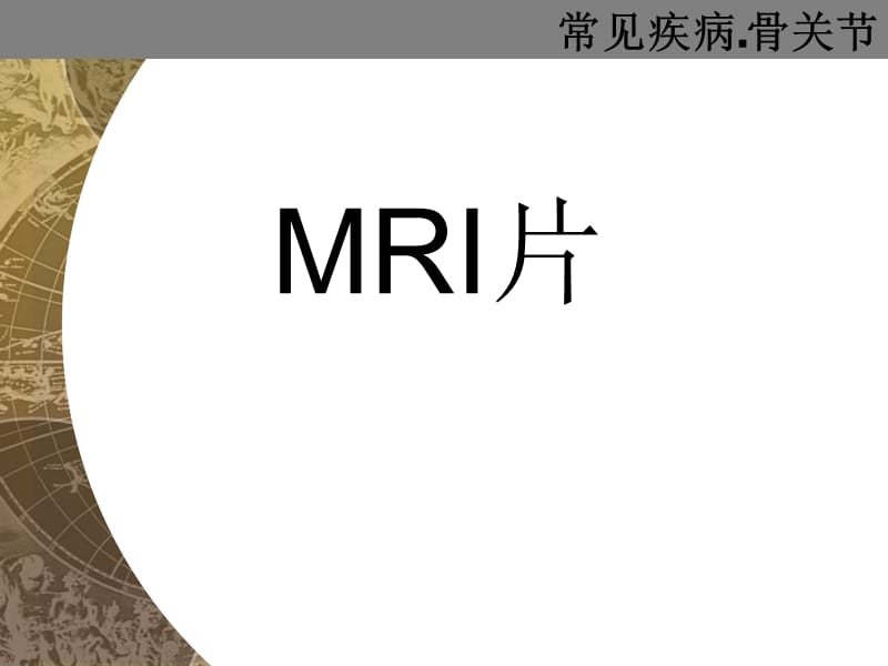 《怎么看MRI片》PPT课件.ppt_第1页