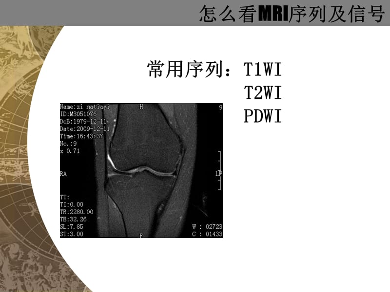 《怎么看MRI片》PPT课件.ppt_第3页