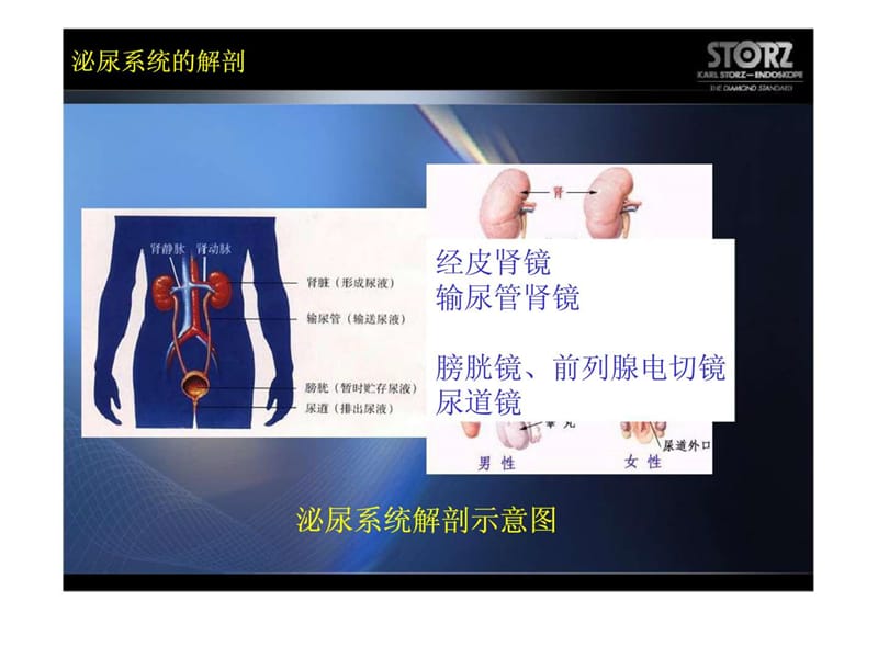 泌尿科经皮肾镜.ppt_第2页