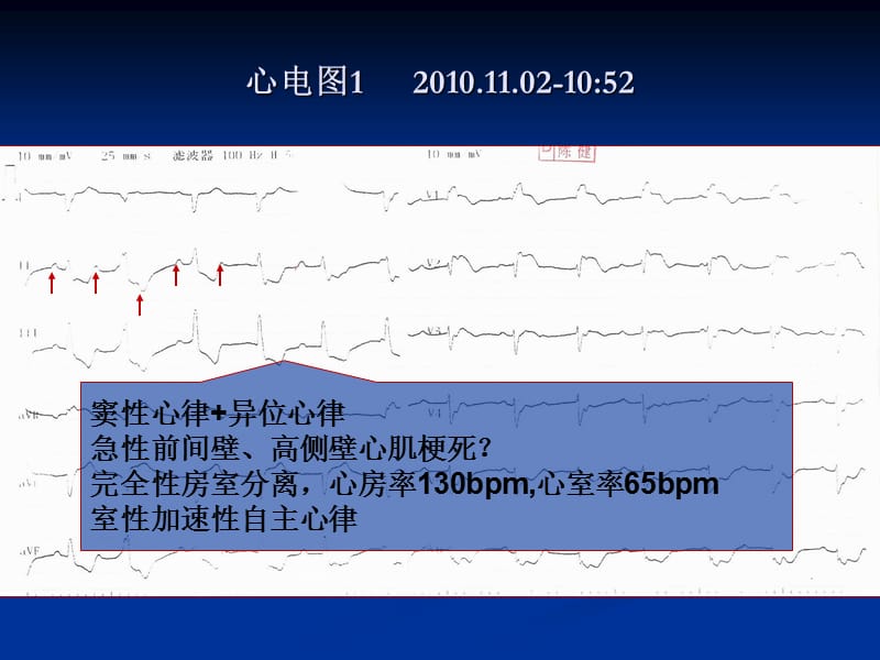 病例讨论-胸痛PPT.ppt_第3页