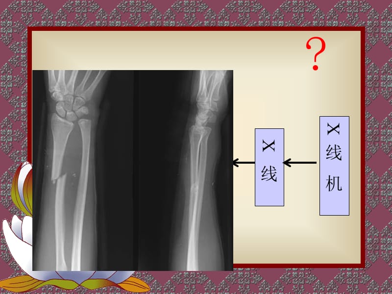 诊断用X线机.ppt_第3页