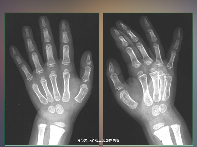 骨与关节系统正常影像表现2003 ppt课件.ppt_第2页