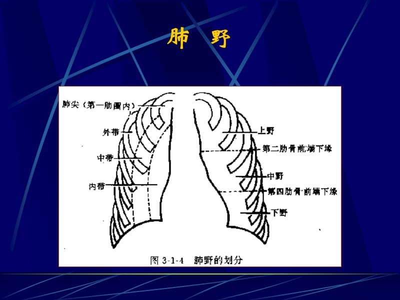 《医师X线读片》PPT课件.ppt_第3页