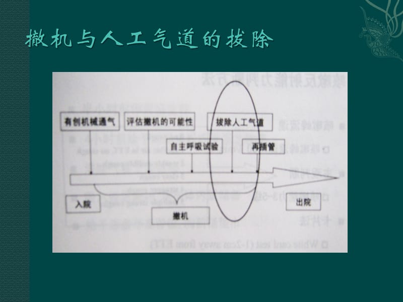 人工气道的拔除及意外脱管PPT课件.ppt_第2页