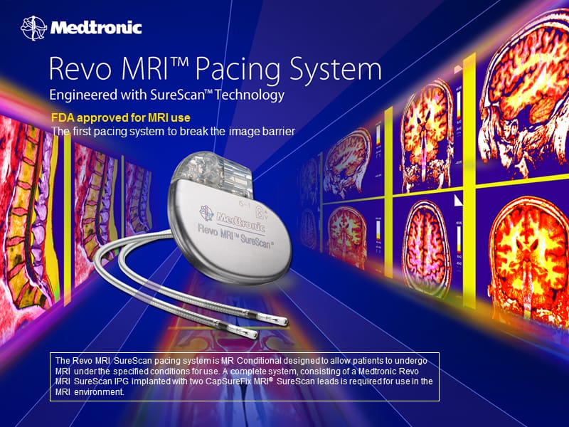 RevoMRISureScanPacemaker-MedtronicCRDMDevice：revoMRIsurescan起搏器-美敦力CRDM装置.ppt_第1页