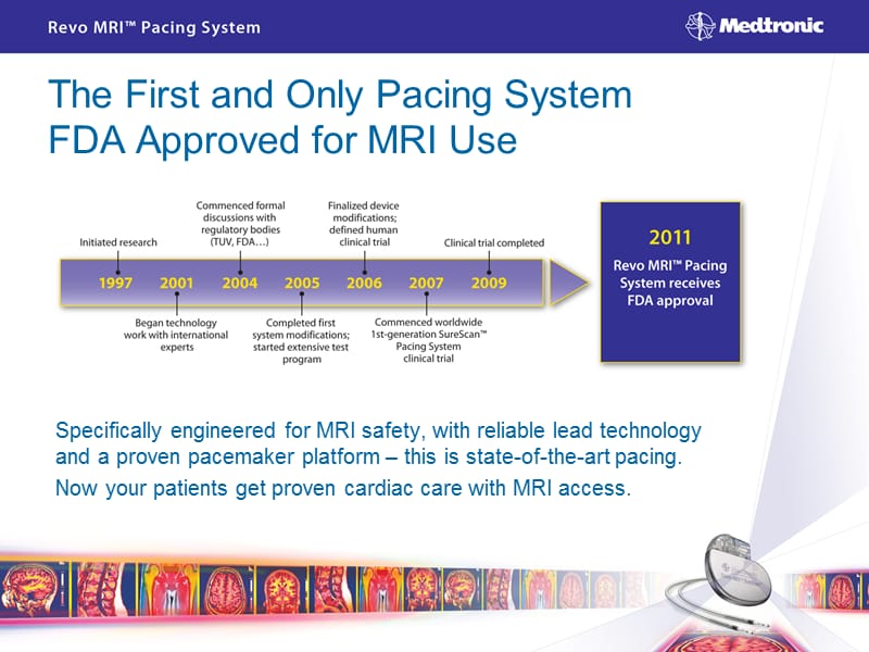 RevoMRISureScanPacemaker-MedtronicCRDMDevice：revoMRIsurescan起搏器-美敦力CRDM装置.ppt_第2页