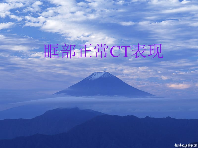 五官及颈胸部疾病的CT诊断PPT课件.ppt_第2页