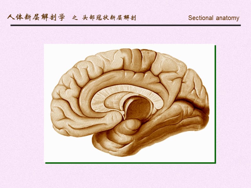 人体断面解剖学-头部冠状断层解剖PPT课件.ppt_第3页