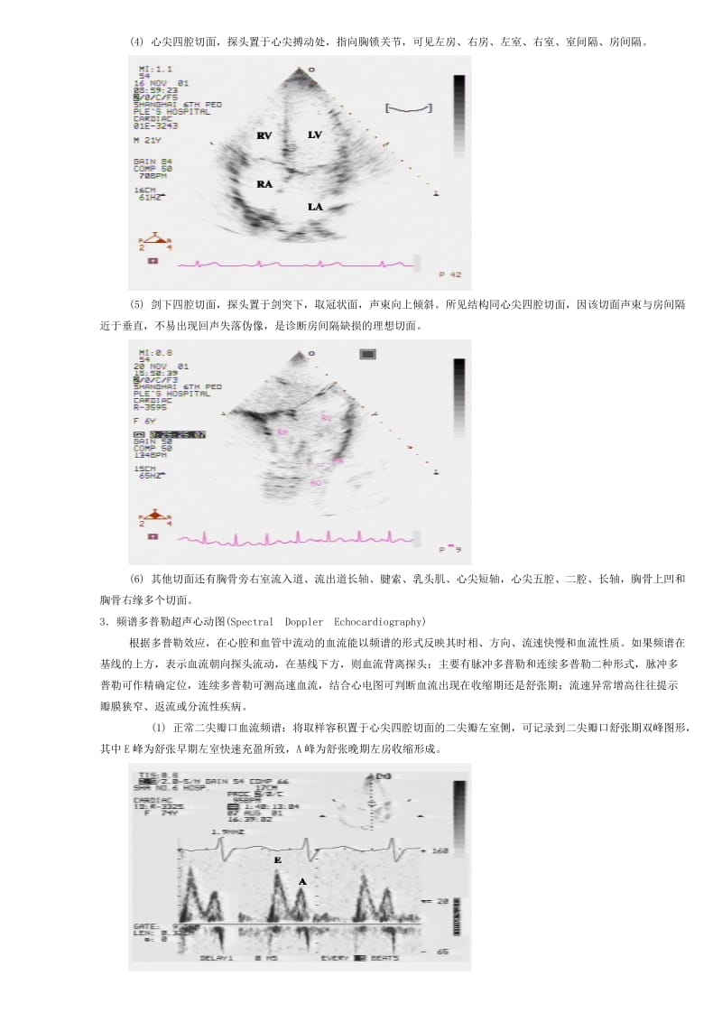 2019超声心动图学.doc_第3页