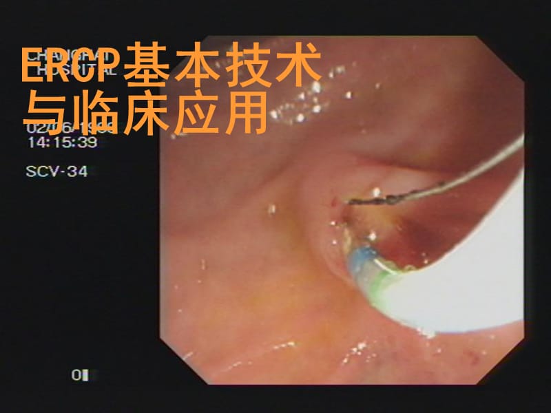 ercp基本技术与临床应用ppt课件.ppt_第1页