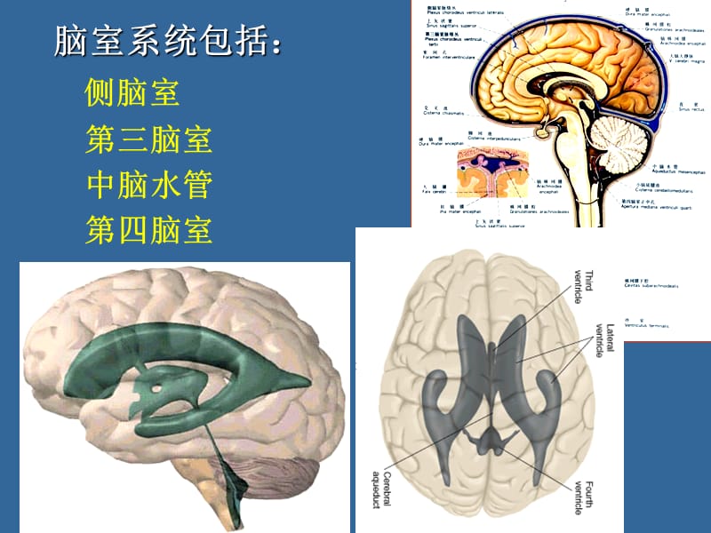 《脑室断层解剖》PPT课件.ppt_第2页