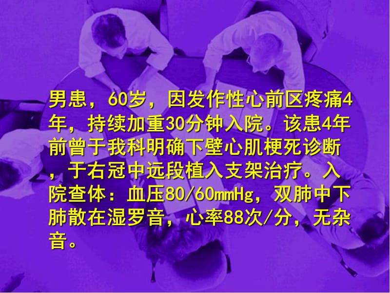 急性心肌梗死伴心源性休克1例_潘洪涛.ppt_第2页