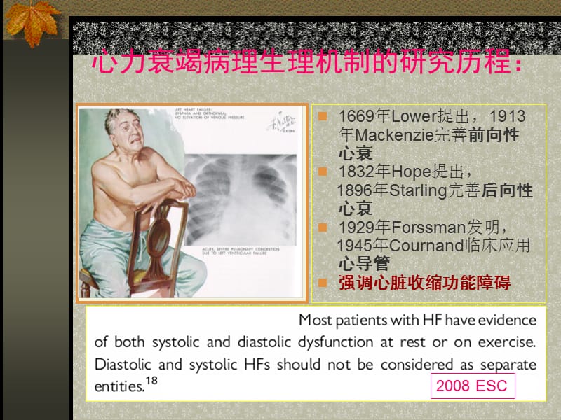 左室射血分数正常的心力衰竭.ppt_第2页