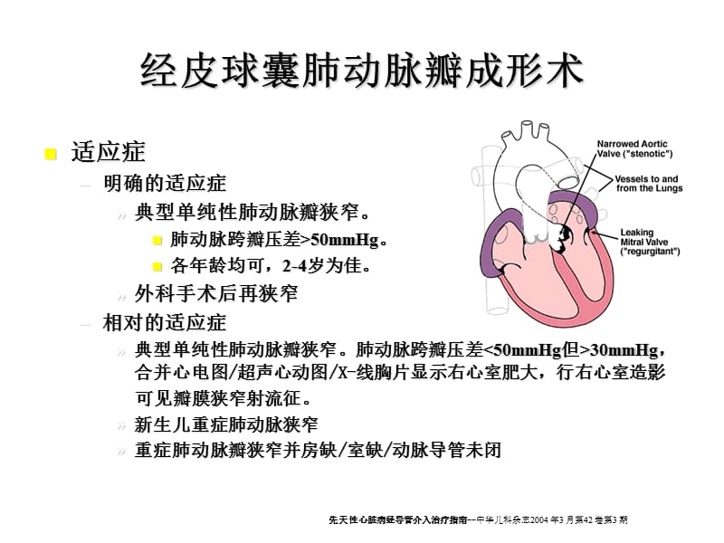 先心病的介入治疗--适应症及病例选择ppt课件.ppt_第3页