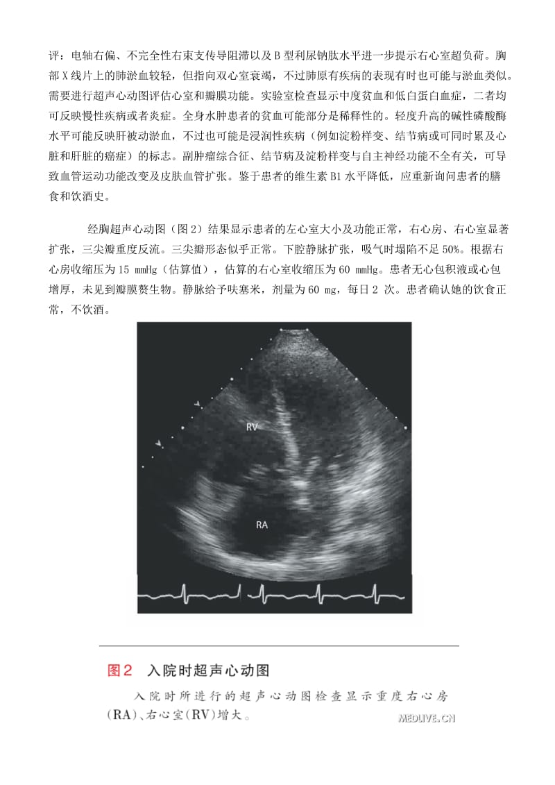 2019边说边解阵发性夜间呼吸困难一例.doc_第3页