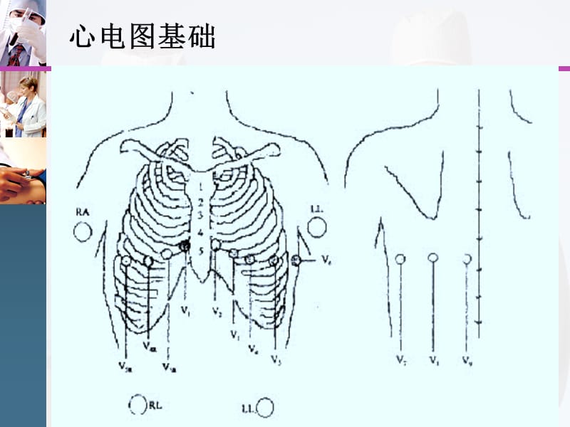 心电图诊断与动态心电图-李蕊.ppt_第3页