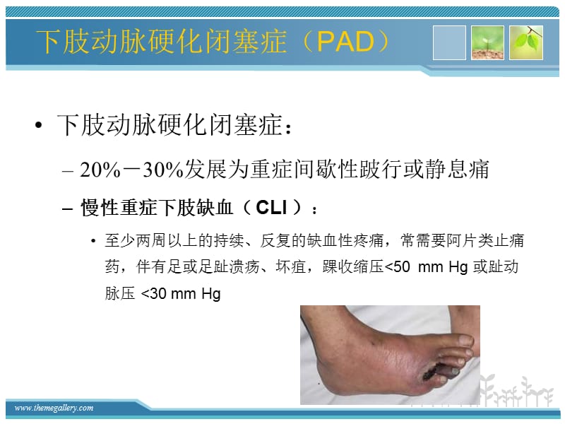 下肢动脉硬化闭塞症及糖尿病足的外科治疗----杂交技术的临床应用.ppt_第2页