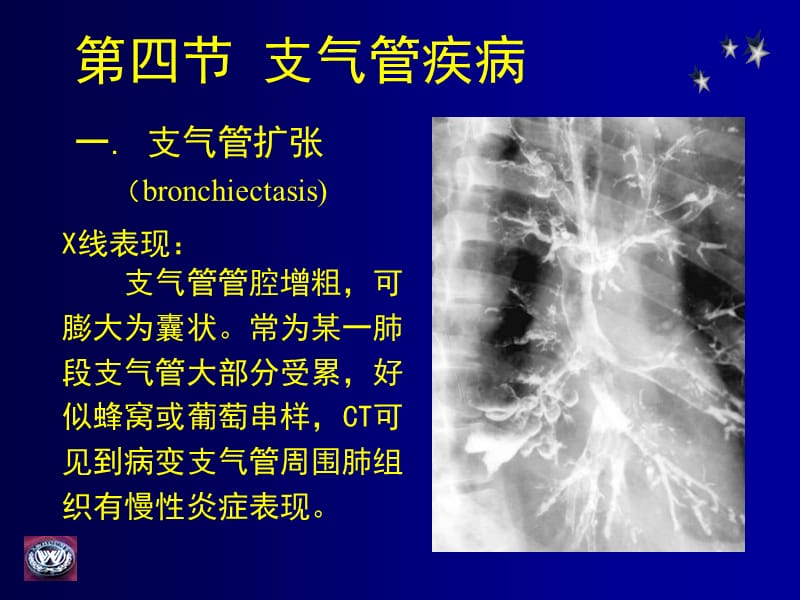 呼吸系统影像诊断.ppt_第1页