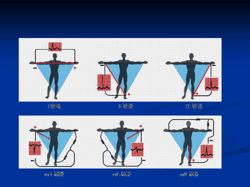 心电图基础知识-教学课件.ppt_第3页