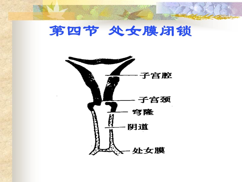 吉林大学二医院王凤文.ppt_第2页