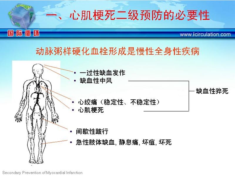 冠心病心肌梗死的二级预防.ppt_第2页