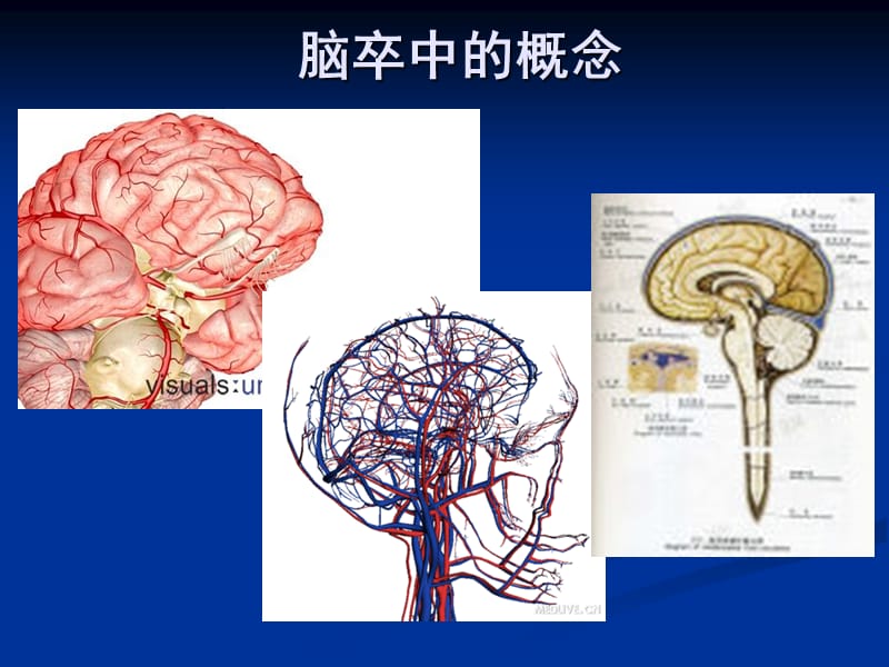 最新卒中二级预防.ppt_第3页