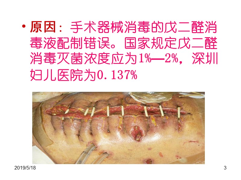 历次重大医院感染事件回顾.ppt_第3页