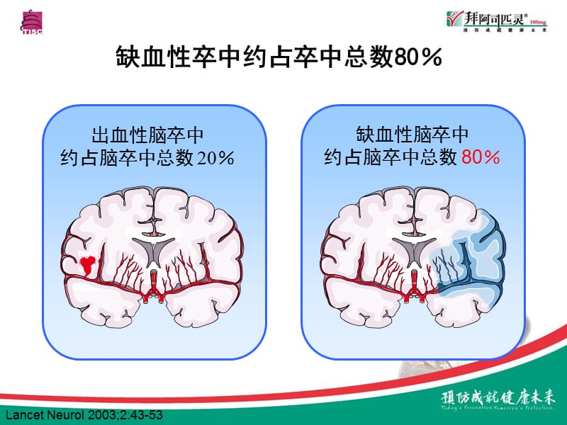 缺血性卒中急性期抗栓治疗的循证与指南_李焰生.ppt_第3页