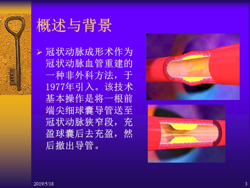 心血管疾病介入诊断治疗_护理.ppt_第3页