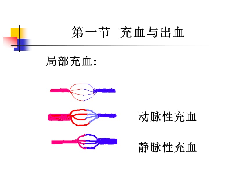 局部血液循环障碍PPT课件.ppt_第3页