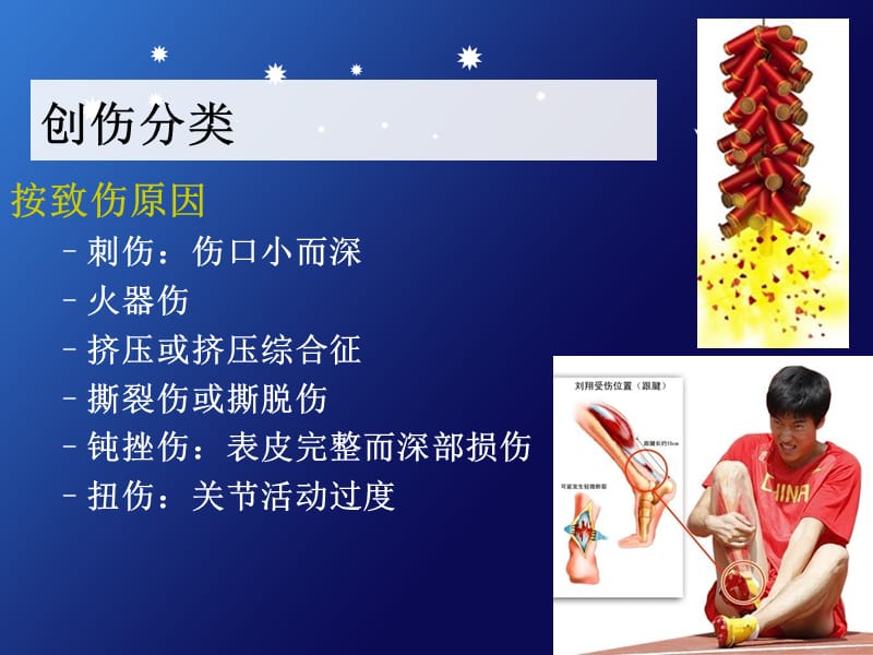 意外伤害现场急救止血.ppt_第3页