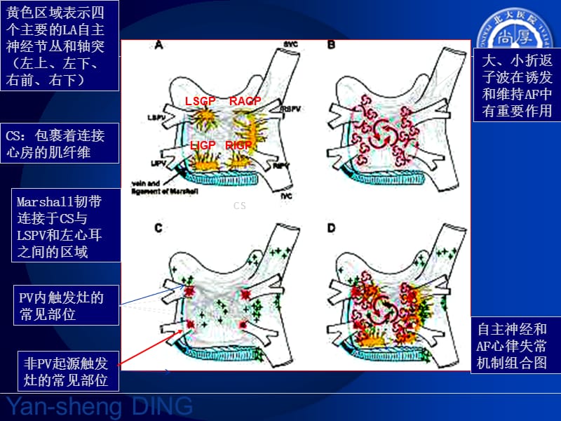 持续房颤消融后复律——消融终点与转律时机_丁燕生.ppt_第2页