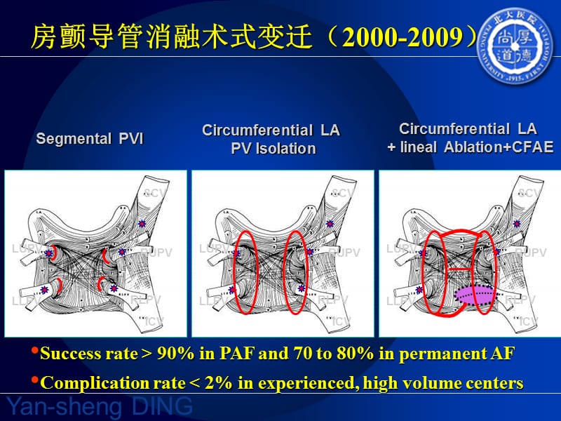 持续房颤消融后复律——消融终点与转律时机_丁燕生.ppt_第3页