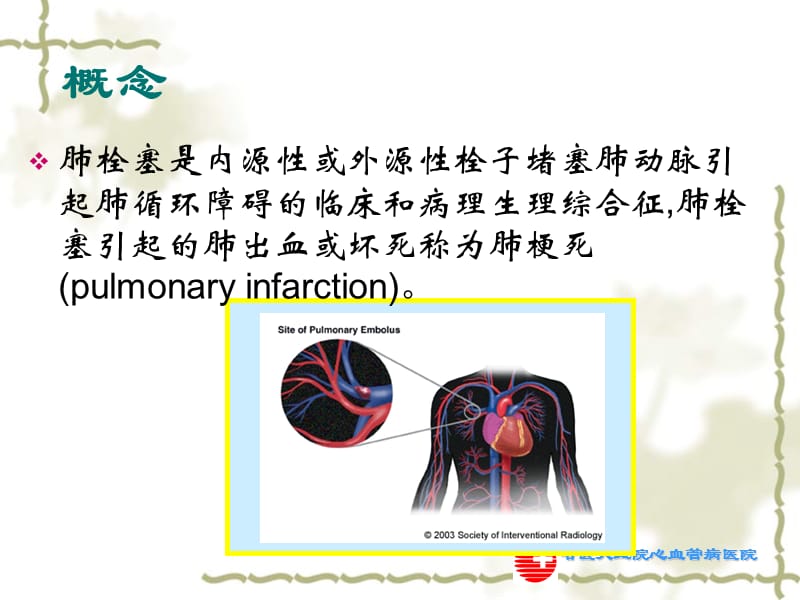 肺栓塞的诊断与治疗.ppt_第2页