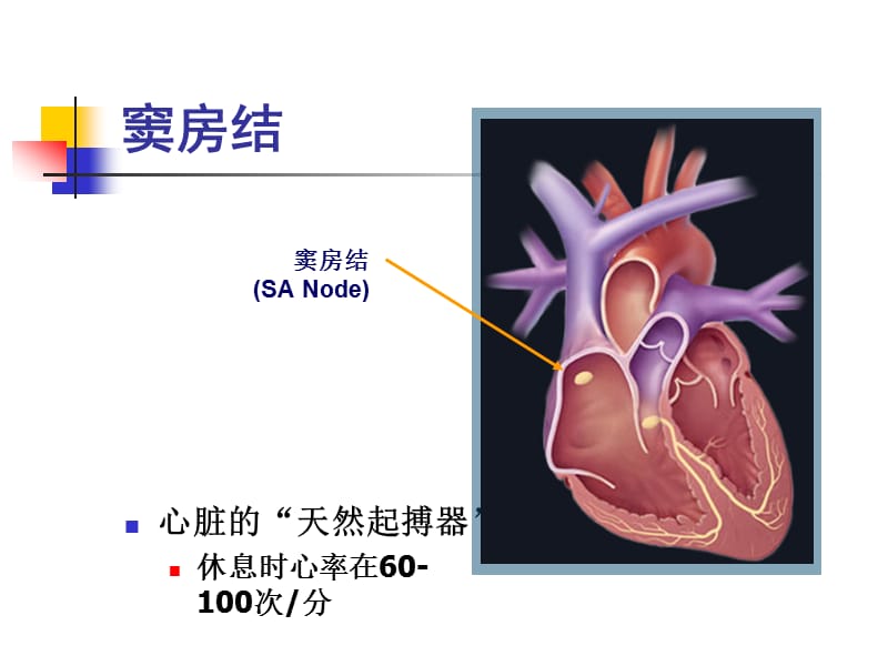 起搏适应证2008.ppt_第3页