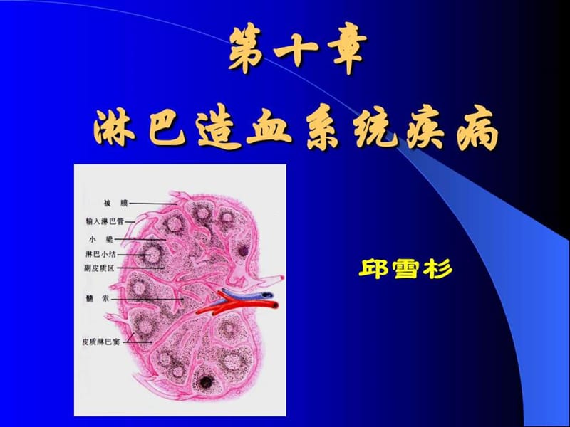 淋巴造血系统疾病(3).ppt_第1页