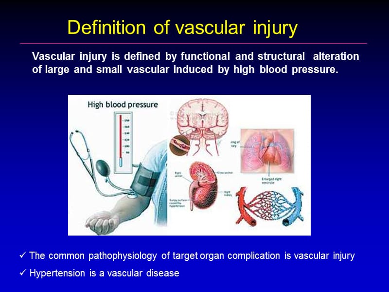 高血压与血管损伤_高平进.ppt_第2页