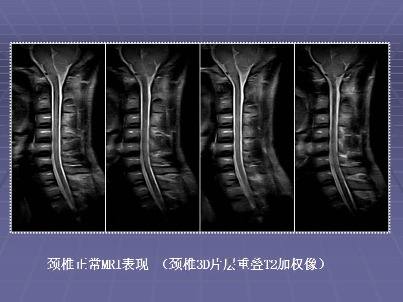 骨科影像学图像资料.ppt_第3页