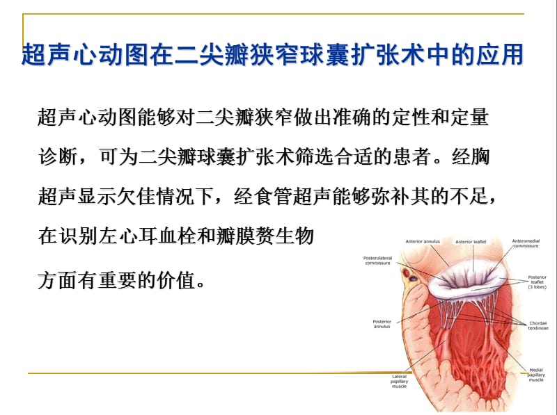 超声心动图在心脏瓣膜病介入治疗中的应用.ppt_第3页