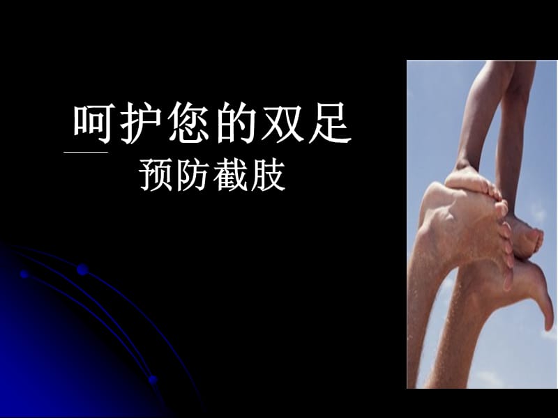 患者教育糖尿病足ppt课件.ppt_第1页