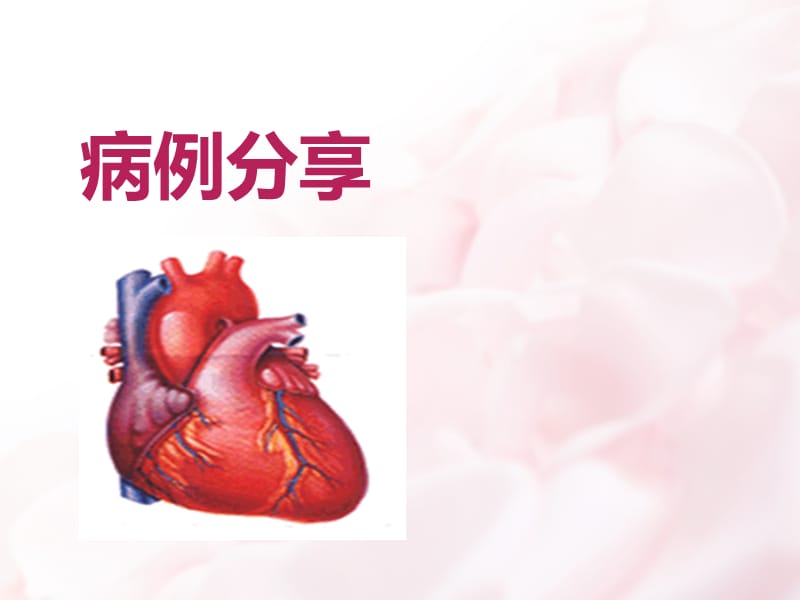 《酒精性心肌病》ppt课件.ppt_第1页