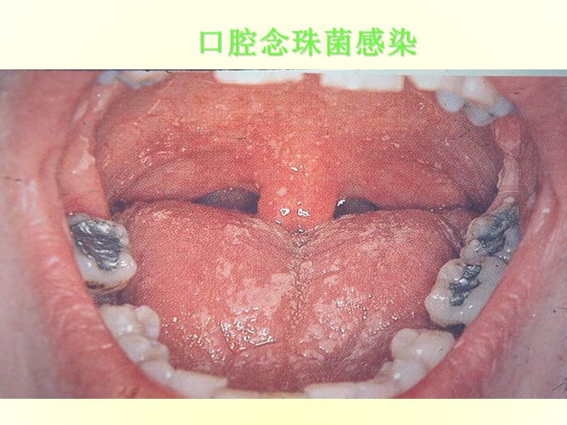 艾滋病PPT专业课件.ppt_第2页