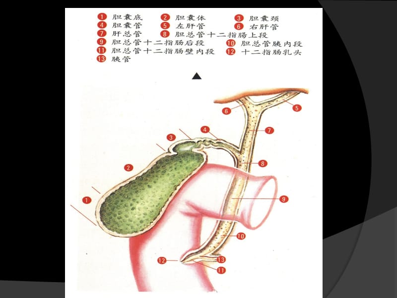 胆囊炎病例分析PPT课件.ppt_第3页