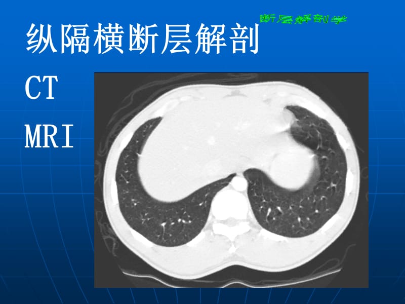 断层解剖学_胸部2PPT课件.ppt_第2页