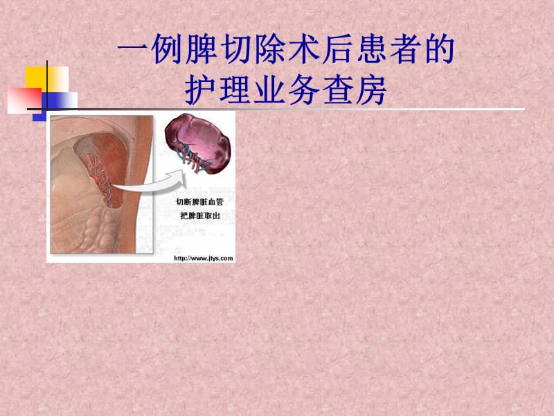 脾切除术后患者的护理业务查房ppt.ppt_第1页