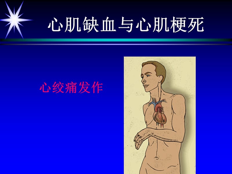 20195心肌缺血、心肌梗死.ppt_第1页