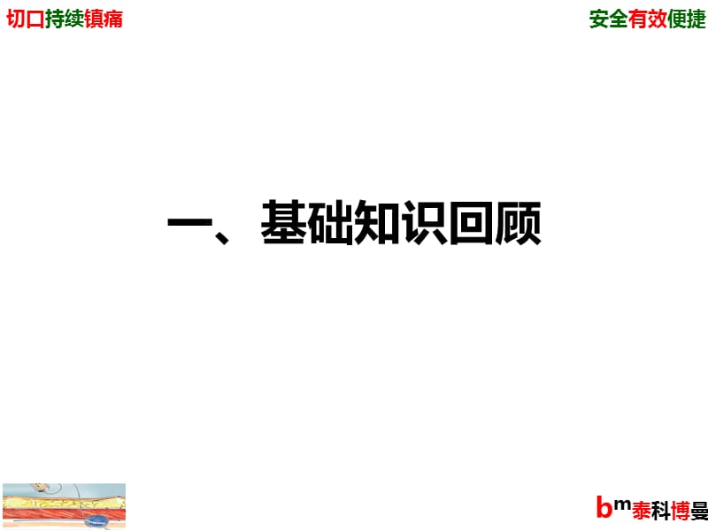 术后切口持续镇痛装置.ppt_第3页