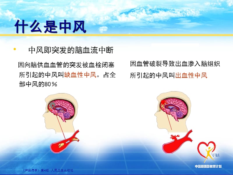 遏制发病源头,预防卒中再发可修改ppt课件.ppt_第2页