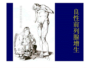 《前列腺增生》PPT课件.ppt